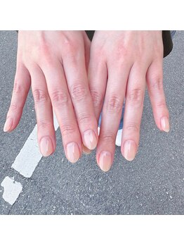 ティリット(TILLIT)/