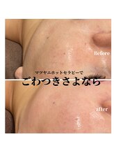 サロン ド リリー(salon de lily)/マツヤニホットセラピー