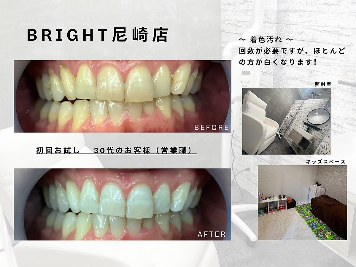 サロン専売☆ホワイトフラッフィー サンエイ 脇高 ハイライトフラワー ブラセット ABCD 大きい