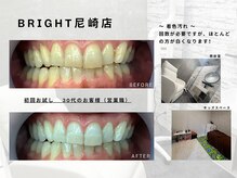 ホワイトニングサロンブライト 尼崎店(Whitening salon bright)