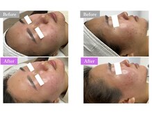 ホワイトワックス 福井店(WHITE WAX)/