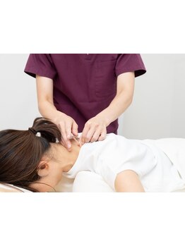 鍼灸施術を受けたい