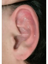 ニコ(nico)/耳ツボ（ジュエリーなし）