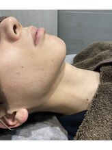 アース オーセンティック 立川店(EARTH Authentic)/【men'sヒゲ脱毛】