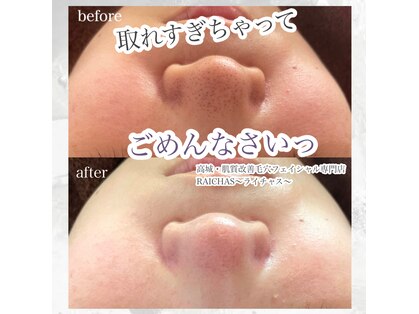 ライチャス(RAICHAS)の写真