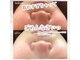 ライチャス(RAICHAS)の写真