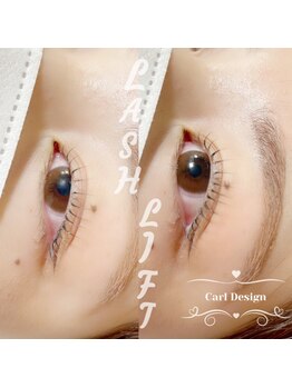 アール(R)/ラッシュリスト