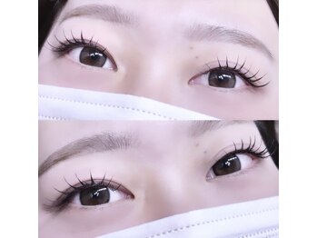 フィールリファイン(Feel Refine)/flatlash