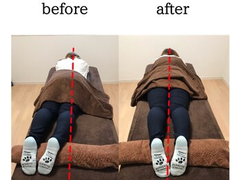 村岡整体院/骨盤矯正(出産なし)のお客様です