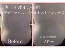 ラネージュ(LA NEIGE)の雰囲気（眼精疲労#ヘッドスパ#肩こり#腰痛#オイルマッサージ#腰痛#痩身）