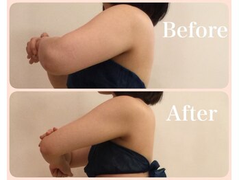 クイーン 熱海店(Queen)/二の腕も60分寝ているだけ!