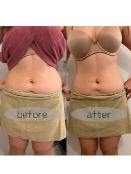 マホロバ セカンド(mahoroba 2nd)/EMSプラス腸活マッサージ