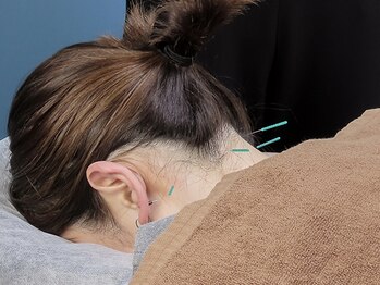 ネウラ 高田馬場院(neula)の写真/【30代からの不調に寄り添う】女性専用サロンで、眼精疲労・肩こり・腰痛を丁寧にケア◎癒しと改善を両立♪