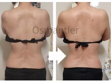 オスマンティエ(Osmantier)の雰囲気（ラジオ波と微弱電流筋膜ケア＆リンパで癒着が緩み自然とほっそり）