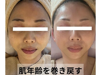 ボニータ(Bonita)の写真