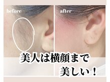 スムース(SMOOTH)/もみあげWAX　板橋/高島平/西台