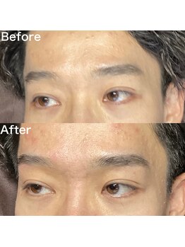 眉毛ハウス 吉祥寺店(眉毛HOUSE)/お客様の施術例(吉祥寺/東京)