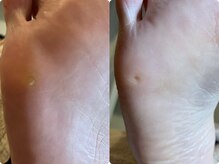 メグムサロン(Megumu Salon)/足つぼ/角質/マッサージ