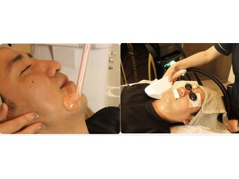 ゴッド(GOD)/毛穴洗浄&光フェイシャル★