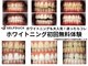 松葉整体 ホワイトニング鈴鹿スマイル館の写真
