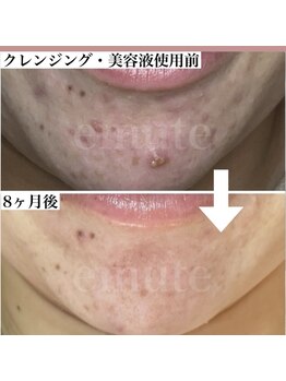 リュミエール デスポワール(Lumiere d'espoir)/ホームケア