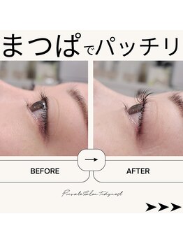 ティディーネスト(Tidynest)/まつげパーマbeforeafter