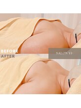 サロン ヴィプラス(SALON Vi+)/バストの土台作り