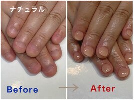 自然なベージュカラーの仕上がり