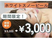 リファイン(Refine)