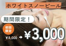リファイン(Refine)