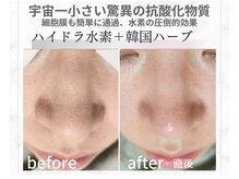 キレイラボ(Ki-Re-i LABO)の雰囲気（殿堂入りＮｏ.１★ご詳細はフォトをご覧ください♪）