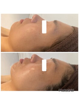 ミュウ(Myu)/フェイシャル