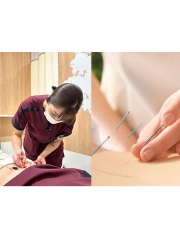 鍼灸施術を受けたい