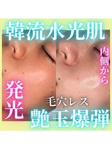 ハニエル(Haniel)/MTSビフォーアフター