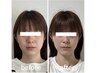 リフトアップ☆ 小顔施術（オールハンド）  通常¥11,000