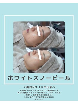 ソワナ(soina)/【神楽坂駅/フェイシャル/毛穴】