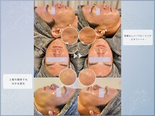 ハーブピーリングのデトックス効果でニキビ・跡にアプローチ。