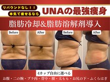 ウナ 西中島店(UNA)