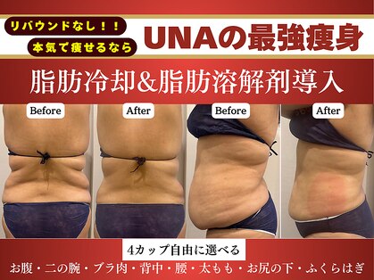 ウナ 西中島店(UNA)の写真