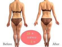 アルピナ(ALPINA)