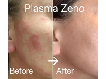 エステサロン ベルジュール/