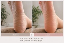 ノエ(Noe’)