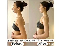 ソウ バイ ソウ(So by 蒼)の雰囲気（ブライダルエステ整体。頬骨/凹凸の目立つ顔/歪みによる厚みetc）