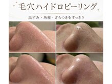 ココニー 天六店(Coconi)の雰囲気（痛みダウンタイム×エステ初心者大歓迎！毛穴洗浄でうるツヤ美肌）