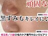【頑固な毛穴の黒ずみに!】化粧崩れしないお肌に♪¥14,000
