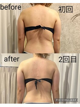 リープ(Lieb)/ボディビフォーアフター