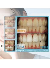 グロウ グロウ(grow.glow)/