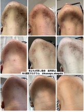 木の葉/若よもぎ蒸し