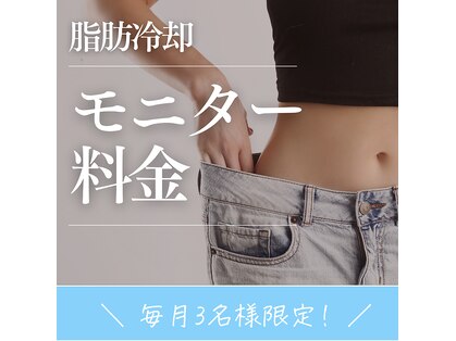 ミネット(minette)の写真