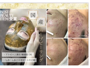 ラピスラズリ(Lapis Lazuli)/ハーブピーリング